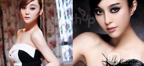 整形手術(shù)是一項(xiàng)不可能完全把你復(fù)制稱為別人的手術(shù)，因?yàn)槟銈兪莾蓚€有著完全不同的身體。影響外表的因素有很多，包括體型、皮膚狀況、總體健康和骨骼結(jié)構(gòu)。此外，整容手術(shù)完成后的愈合*果也會因人而異，這也是為什么你永遠(yuǎn)無法得到和別人一樣的結(jié)果的另一個原因。根據(jù)這些信息，一定要記住，你應(yīng)該嘗試以一種*適合你的體型的方式來整形。如果你把你的理想手術(shù)描述為‘我想看起來像這個人，你的外科醫(yī)生可能會提前警告你這是不現(xiàn)實(shí)的。