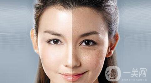 鐳射美白嫩膚*果