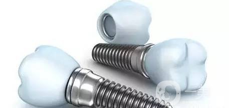 人工種植牙齒價(jià)格 手術(shù)費(fèi)用多少錢？