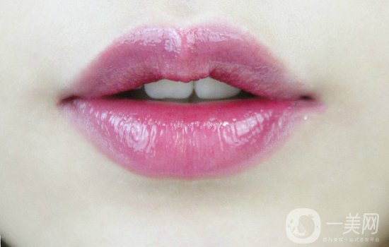 玻尿酸豐唇后會腫嗎？玻尿酸豐唇注意事項