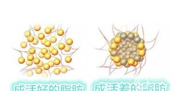 怎么讓脂肪成活率高一點(diǎn) 影響成活率的因素