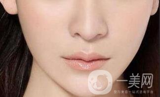 下巴打幾次能定型*,尿酸墊下巴多少錢