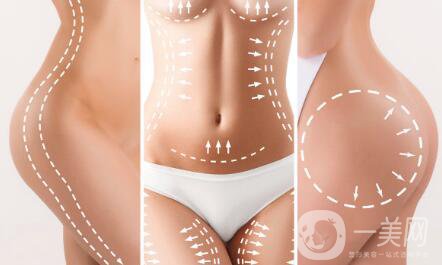 吸脂一般是怎樣收費(fèi)的呢?