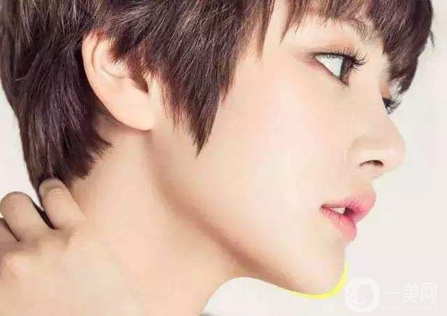 脂肪墊下巴好嗎 恢復(fù)時間是多久