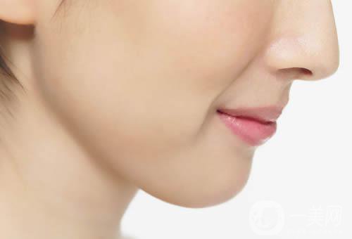 脂肪墊下巴好嗎 恢復(fù)時間是多久