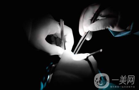 軟骨隆鼻能保持多久？軟骨隆鼻怎么樣？