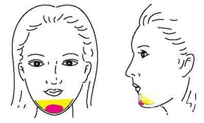 自體脂肪豐下巴能維持多久時(shí)間 多少錢呢？