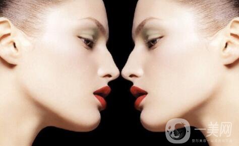 自體脂肪下巴吧多久恢復(fù) 能維持多長(zhǎng)時(shí)間呢