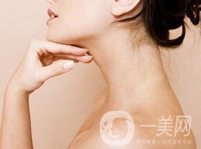 雙下巴抽脂術(shù)