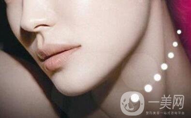 抽脂墊下巴多少錢