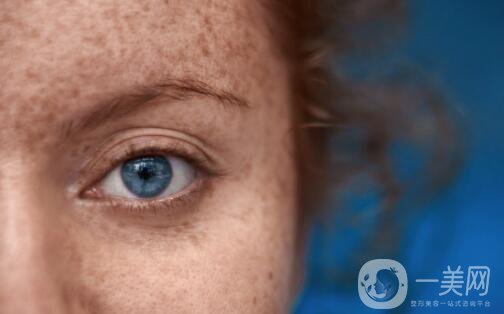 激光祛斑幾天可以洗臉？激光祛斑注意事項(xiàng)