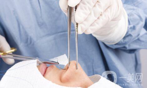 隆鼻手術(shù)有什么*果？它的風(fēng)險(xiǎn)有哪些？