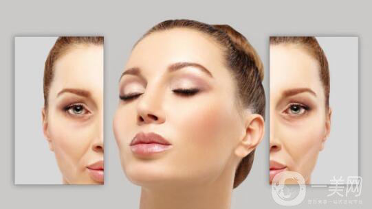 臉部哪里容易長皺紋？臉上皺紋怎么去除