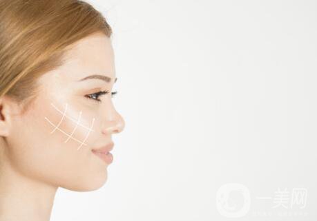 伊婉玻尿酸多少錢一支？玻尿酸每個(gè)部位用量