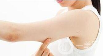 手臂舉升手術(shù)康復(fù)