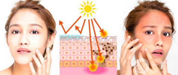 如何快速治好曬傷?來自*皮膚科醫(yī)生的15個提示
