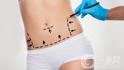 環(huán)形吸脂減肥是什么？吸脂后皮膚會不會松弛？