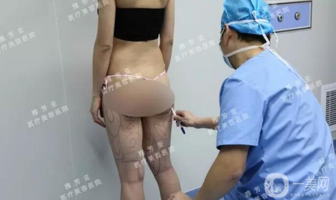 水動(dòng)力溶脂減肥,*果