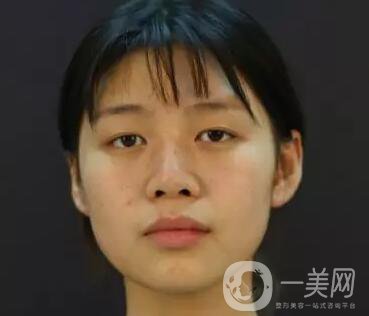 石家莊整形美容信息介紹？美聯(lián)臣整形怎樣？美聯(lián)臣價格