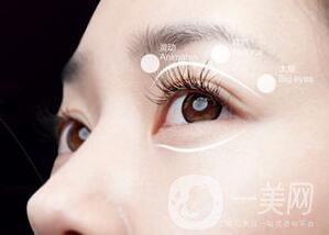 割雙眼皮有哪些風險