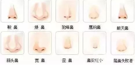 朝天鼻整形多少錢?*丑的幾種鼻子圖片