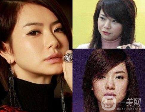 成都眼部整形專(zhuān)題 明星眼部整形