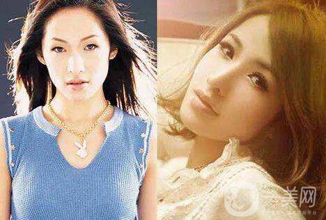 成都眼部整形專(zhuān)題 明星眼部整形