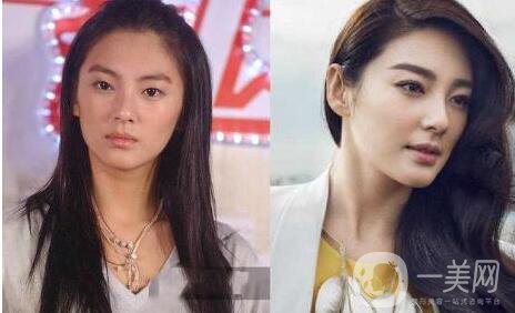 成都眼部整形專(zhuān)題 明星眼部整形