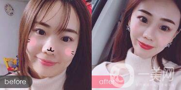 成都*價(jià)格 **果圖