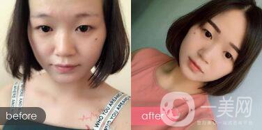 成都紋眉價(jià)格 成都現(xiàn)在文眉多少錢?