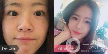 成都紋眉價(jià)格 成都現(xiàn)在文眉多少錢?