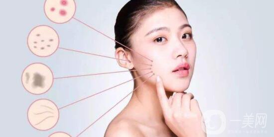 激光除斑要幾天才好 激光除斑多久可以洗臉呢