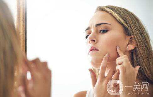 什么是囊性痤瘡?是什么引起了囊性痤瘡?