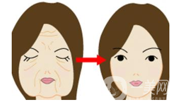 電波拉皮除皺術(shù)要做幾次 有人做過電波拉皮嗎