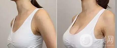 蔣小花醫(yī)生