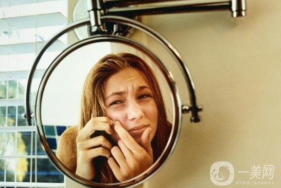 果酸祛痘副作用