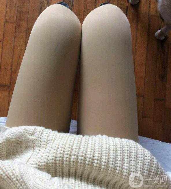 水動力吸脂親身經(jīng)歷