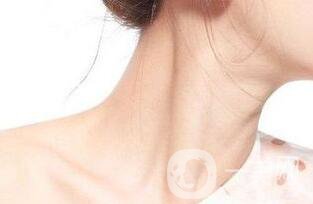 頸紋該怎么消除