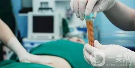 自體脂肪移植注意事項