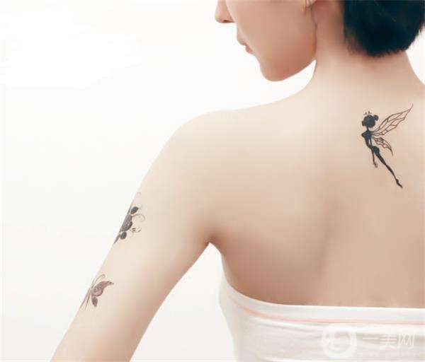 紋身去除**的4種方法 