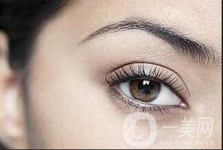 內(nèi)吸去眼袋價(jià)格