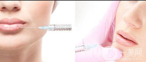 打一針膠原蛋白多少錢