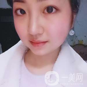 去頰脂墊瘦臉、