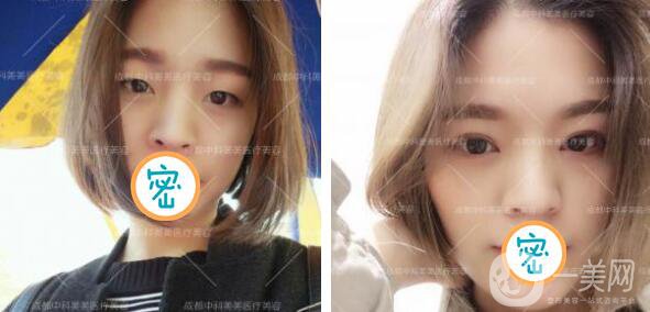 成都中科美美整形美容2019全新價(jià)格表