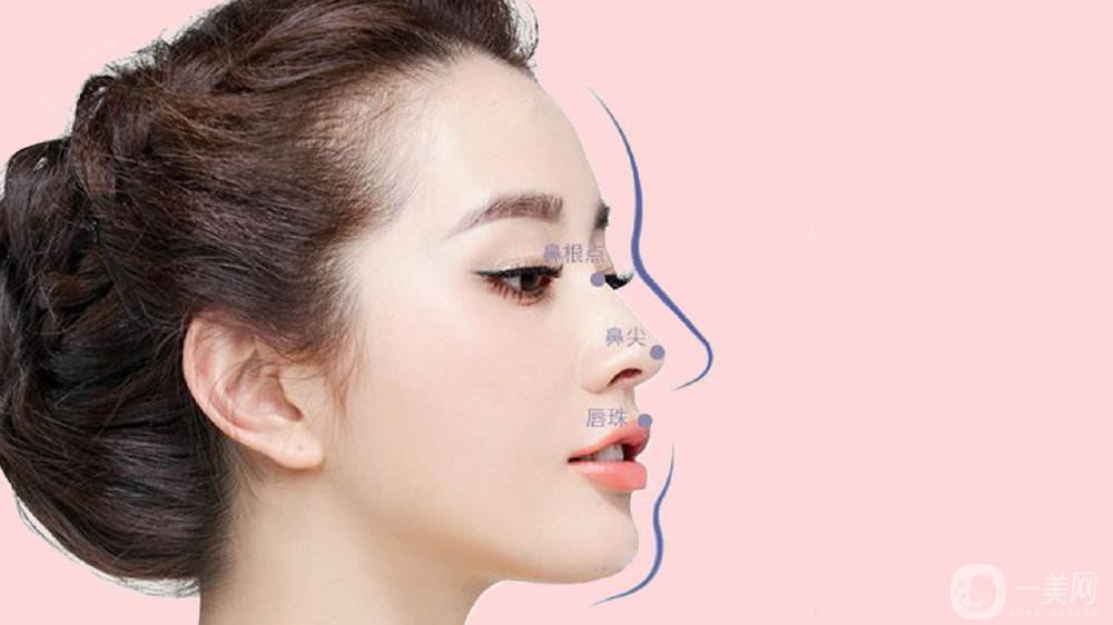 成都鼻翼縮小費(fèi)用是多少呢