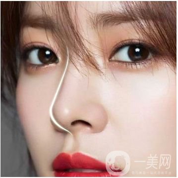 成都瑞蘭隆鼻多少錢(qián)呢