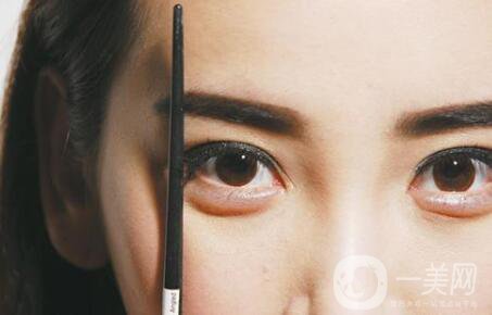 秀眉一般要多少錢