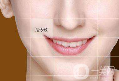 去法令紋多少錢