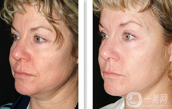 黑臉娃娃做幾次*