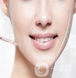 成都玻尿酸價格